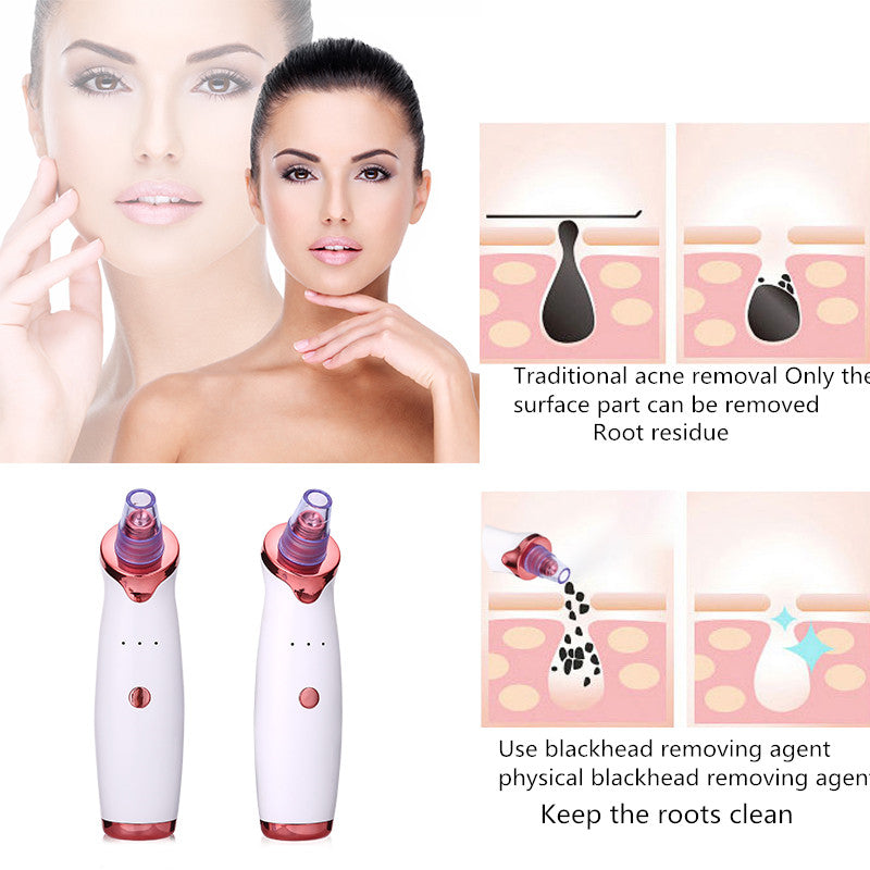 Blackhead Remover | Black Dot Remover | Acne Vacuum Suction Tool